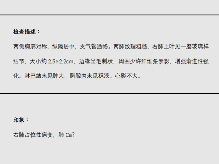 胡晓晨-小细胞肺癌(青年男性不幸患小细胞肺癌，手术+放疗使其重拾希望！).png