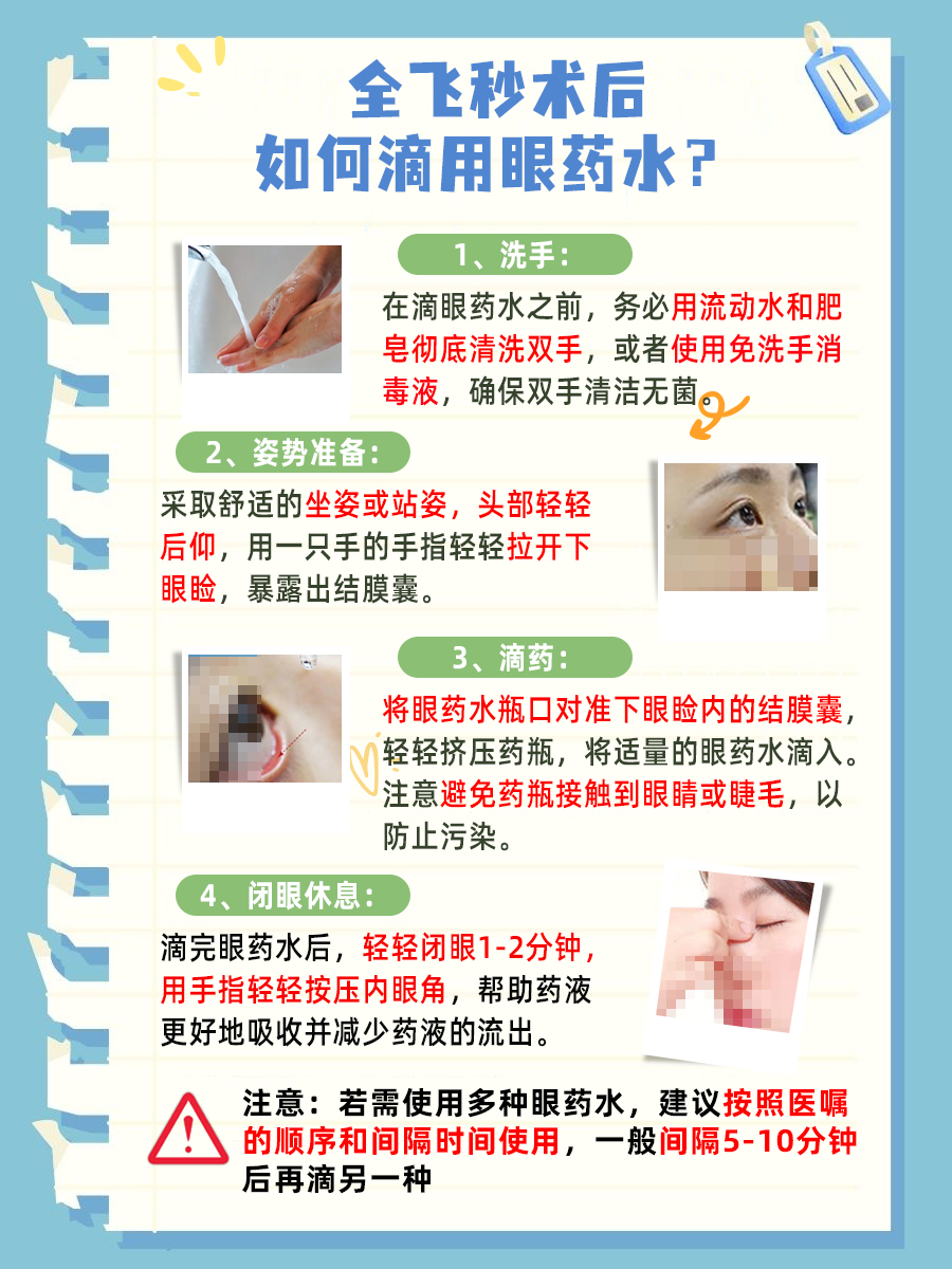 全飞秒术后注意事项，一文讲清！