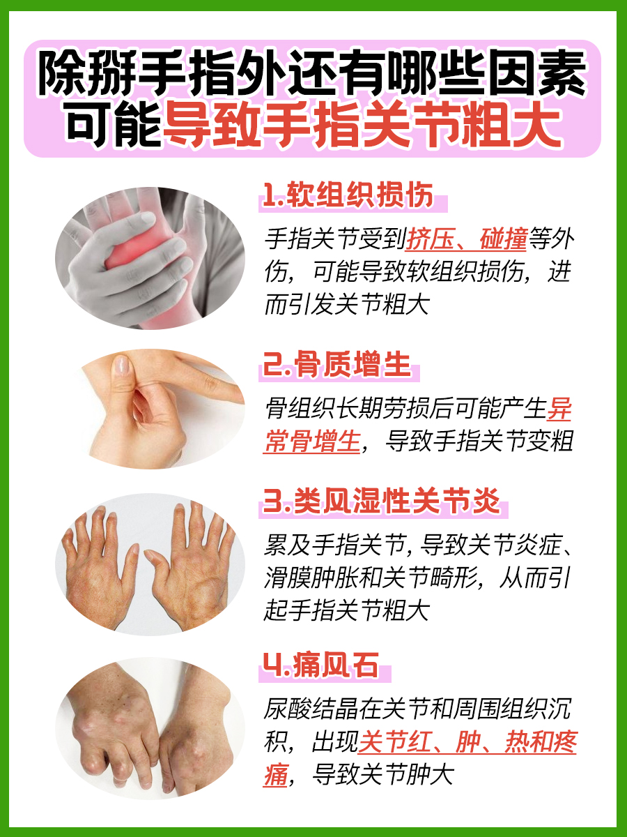 医生解答:掰手指关节粗大怎么恢复