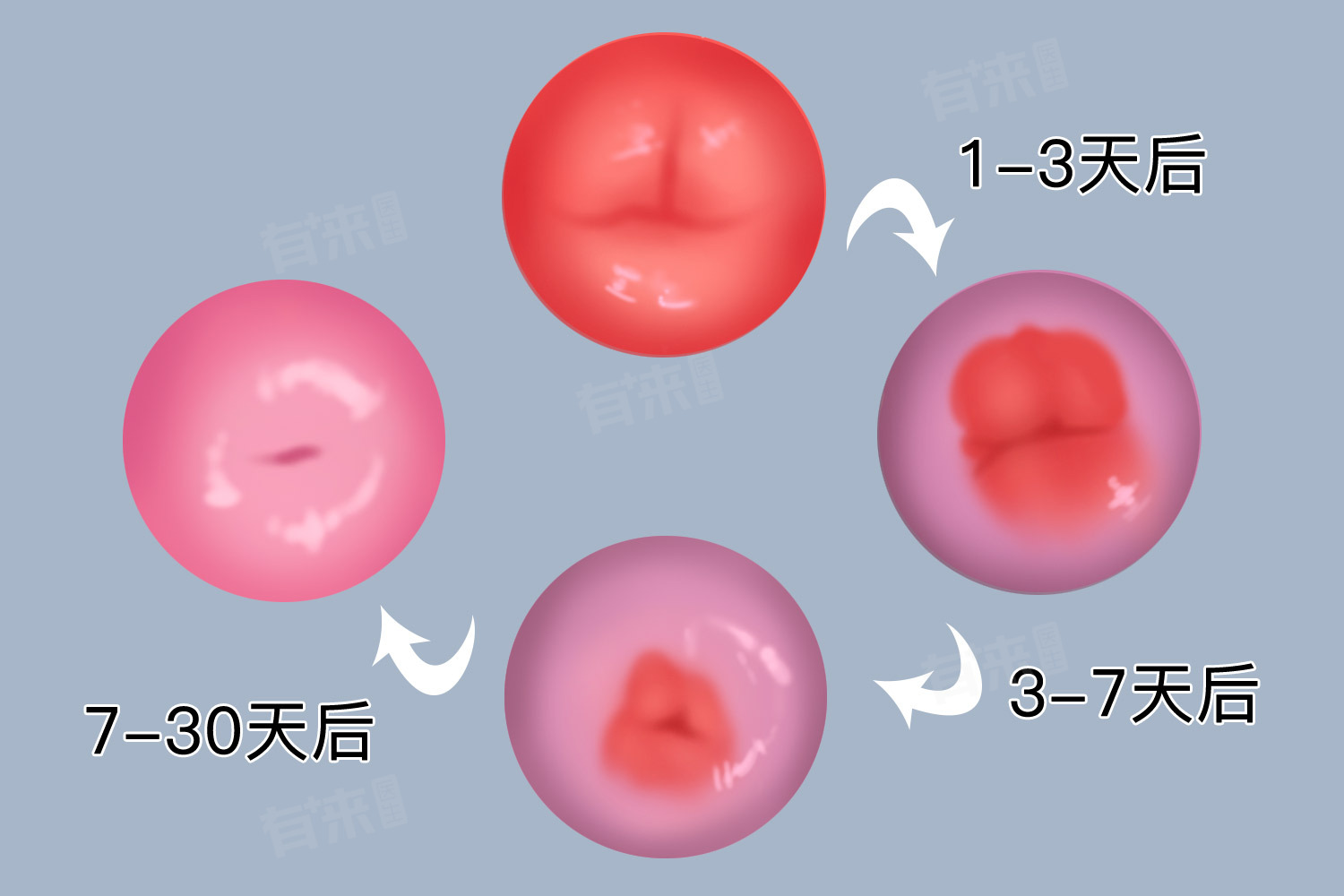 利普刀多少钱宫颈利普刀手术一般多少钱_https://www.jmylbn.com_品牌排行榜_第1张