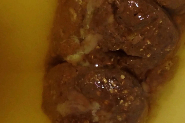 大肠癌赤白脓血便图