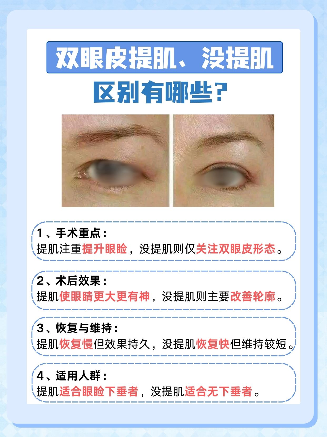 双眼皮提肌VS没提肌，看看区别在哪里