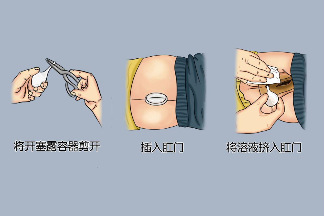 开塞露使用方法图 开塞露使用方法图