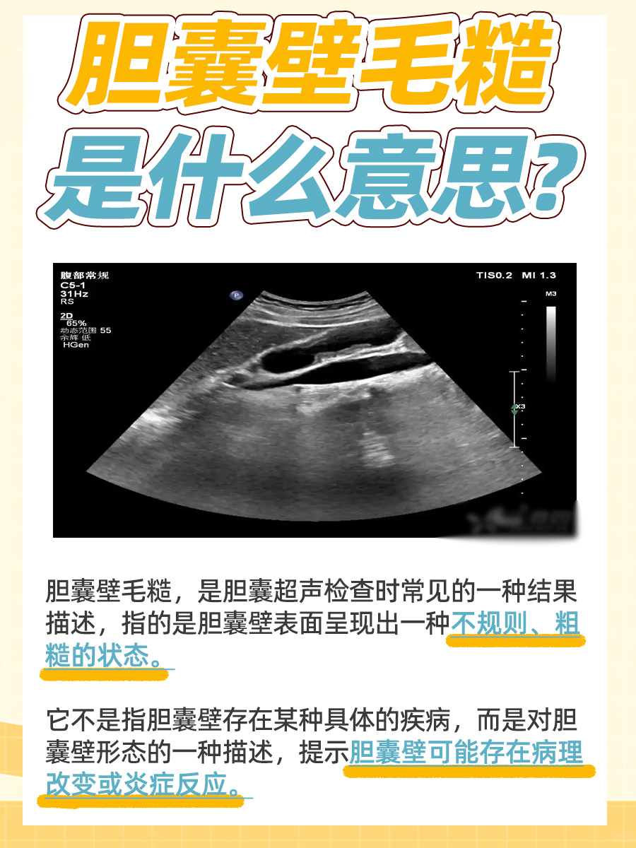 胆囊壁毛糙,意思不明?一起来聊聊