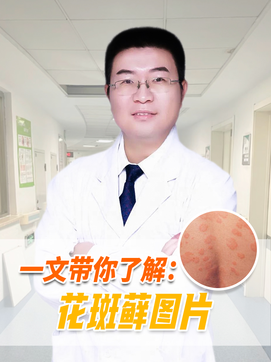 一文带你了解：花斑藓图片