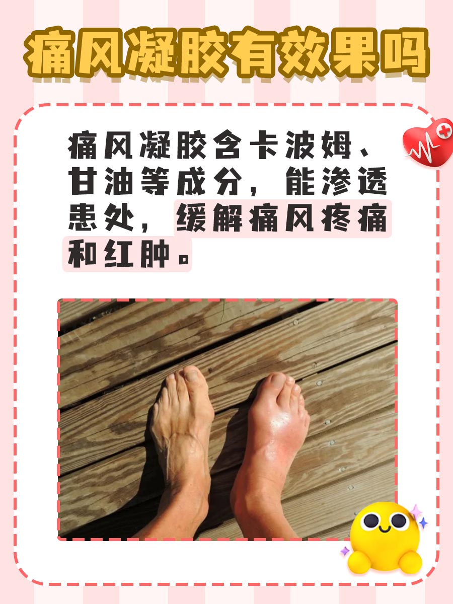 痛风凝胶：有效缓解痛风不适的新选择？