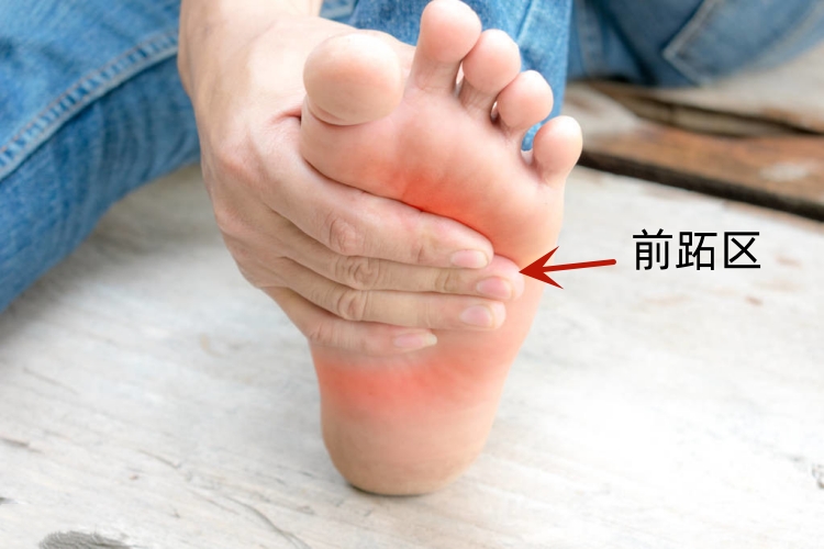 脚底前跖区图 脚底前跖区图