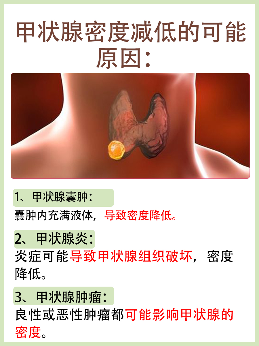 甲状腺密度降低 ：了解这一超声检查结果的意义