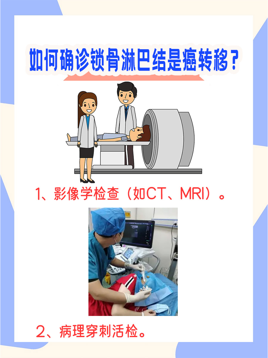 癌友需知：锁骨淋巴结超过1cm，小心癌转移！