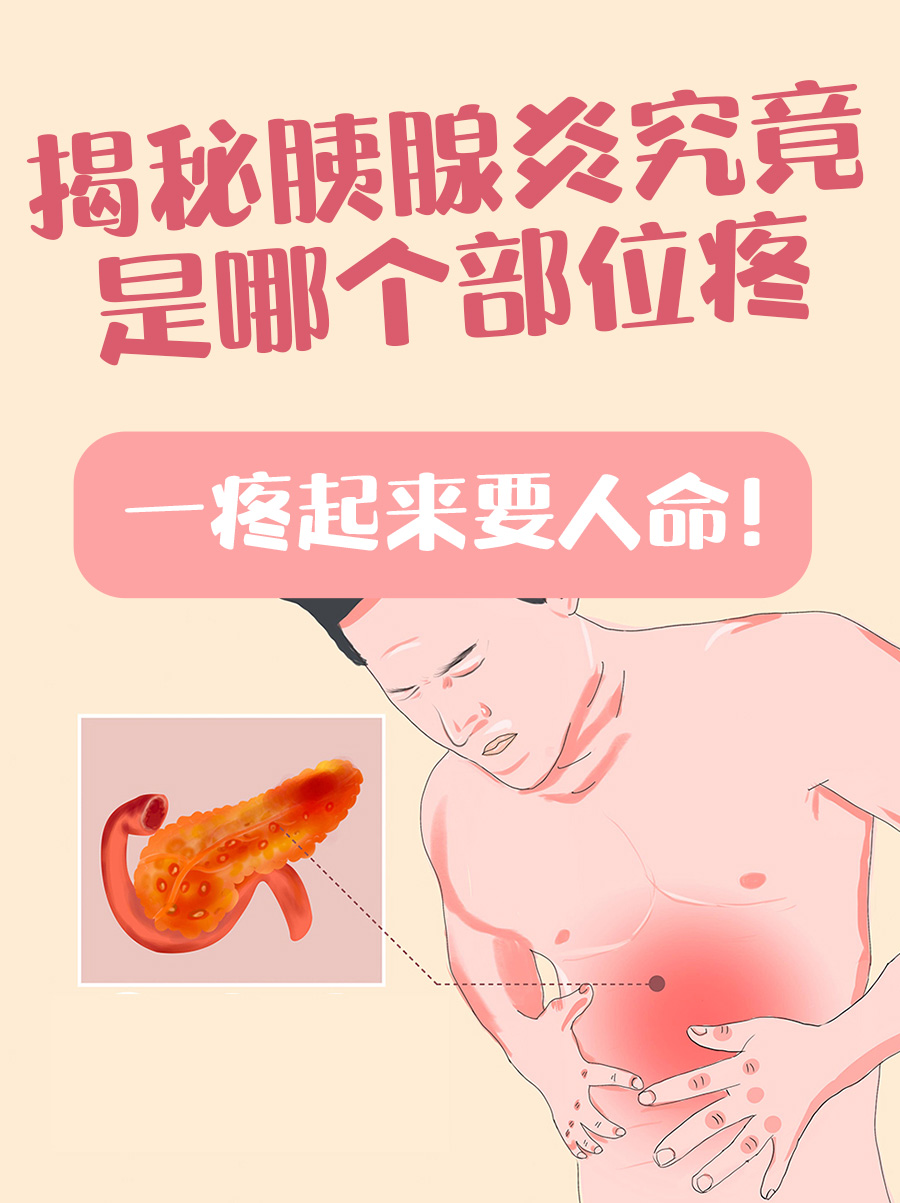 一疼起来要人命！揭秘胰腺炎究竟是哪个部位疼