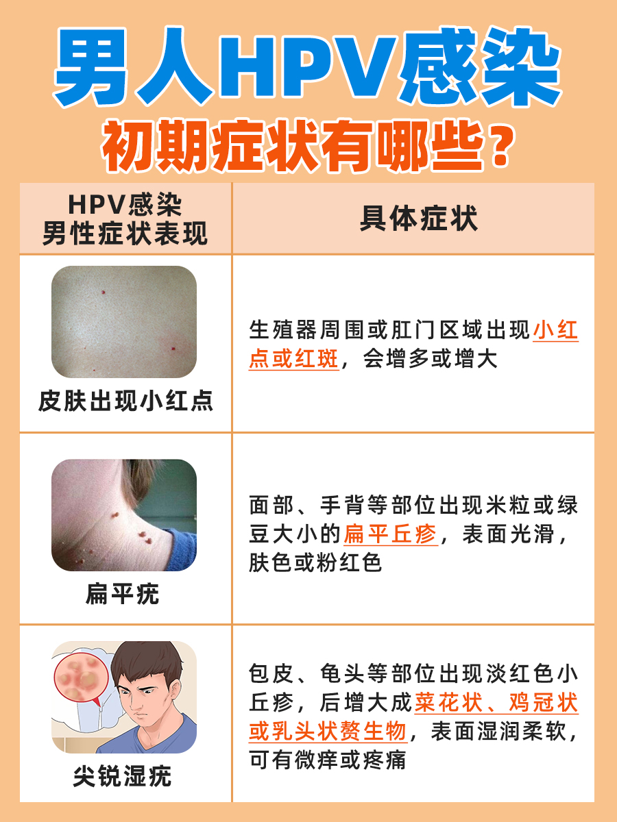 男人HPV感染症状初期图片