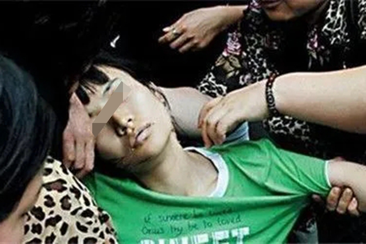 癫痫失神发作图 癫痫失神发作图