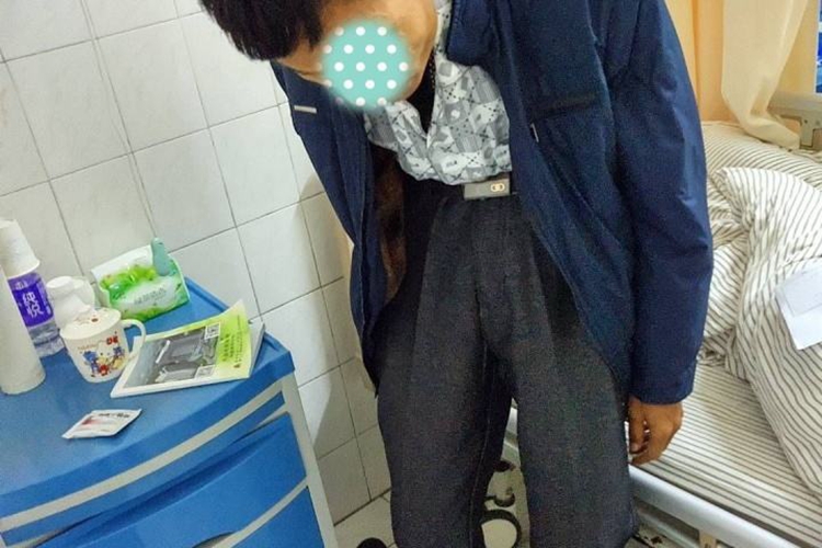 老人强直性脊柱炎图 老人强直性脊柱炎图