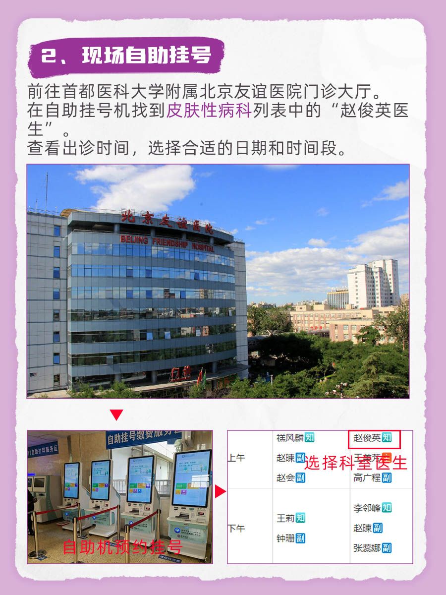 北京友谊医院赵俊英医生怎么样？怎么挂号？