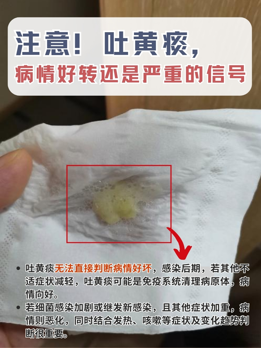 注意！吐黄痰，病情好转还是严重的信号