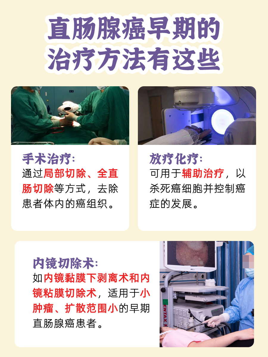 直肠腺癌早期判定:大小有讲究