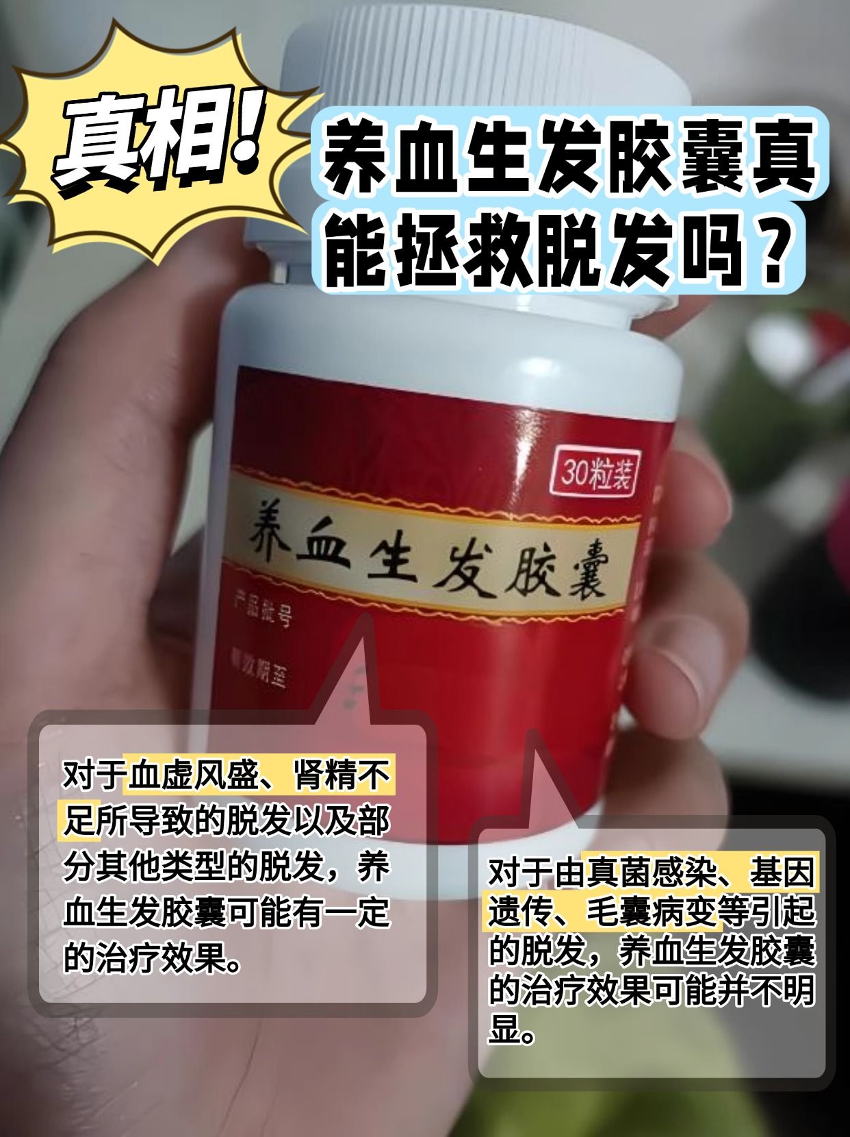 真相！养血生发胶囊真能拯救脱发吗？