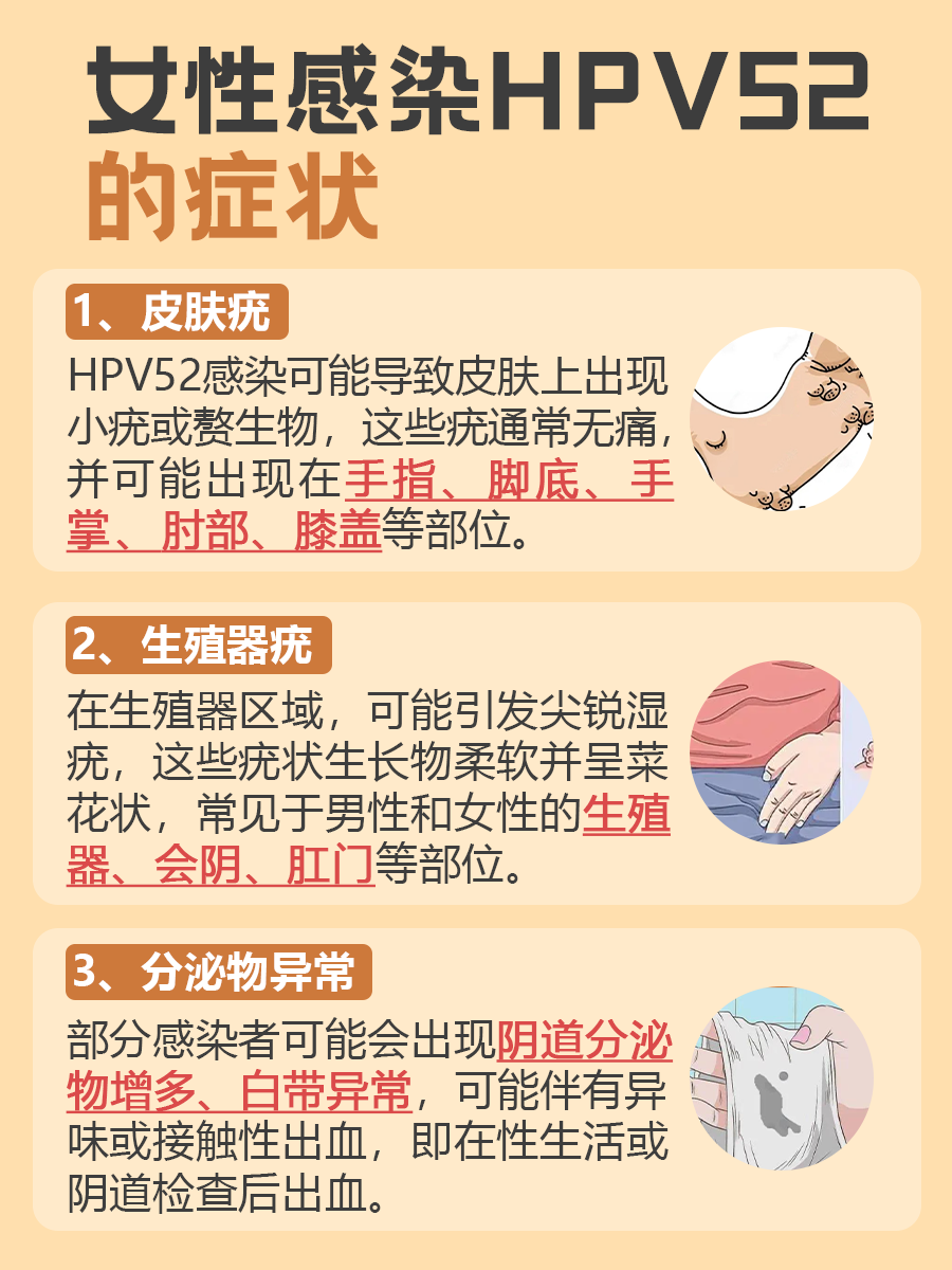 医生告诉你:女性是怎么感染HPV52的
