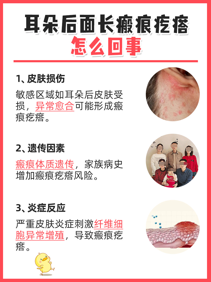 耳后瘢痕疙瘩成因，详细解答！