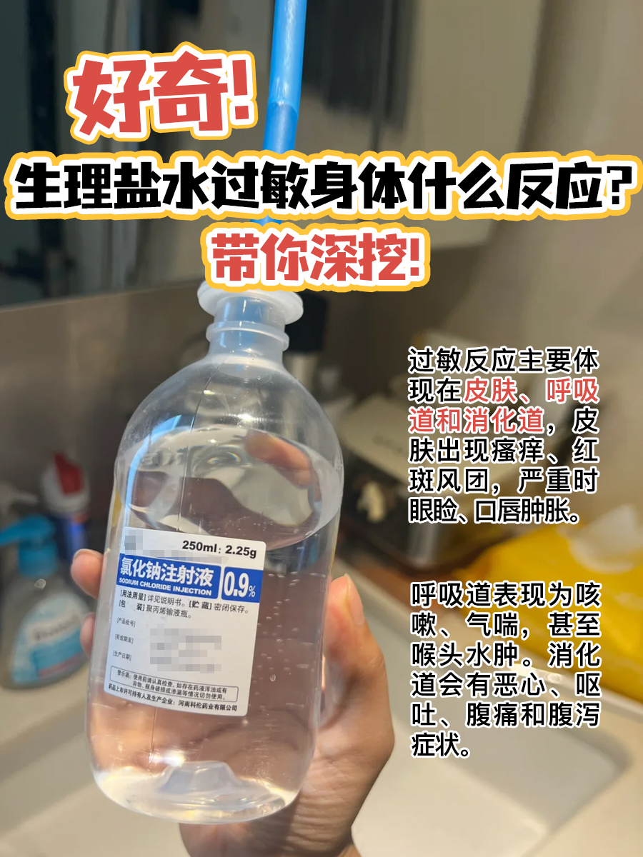 好奇！生理盐水过敏身体什么反应？带你深挖！
