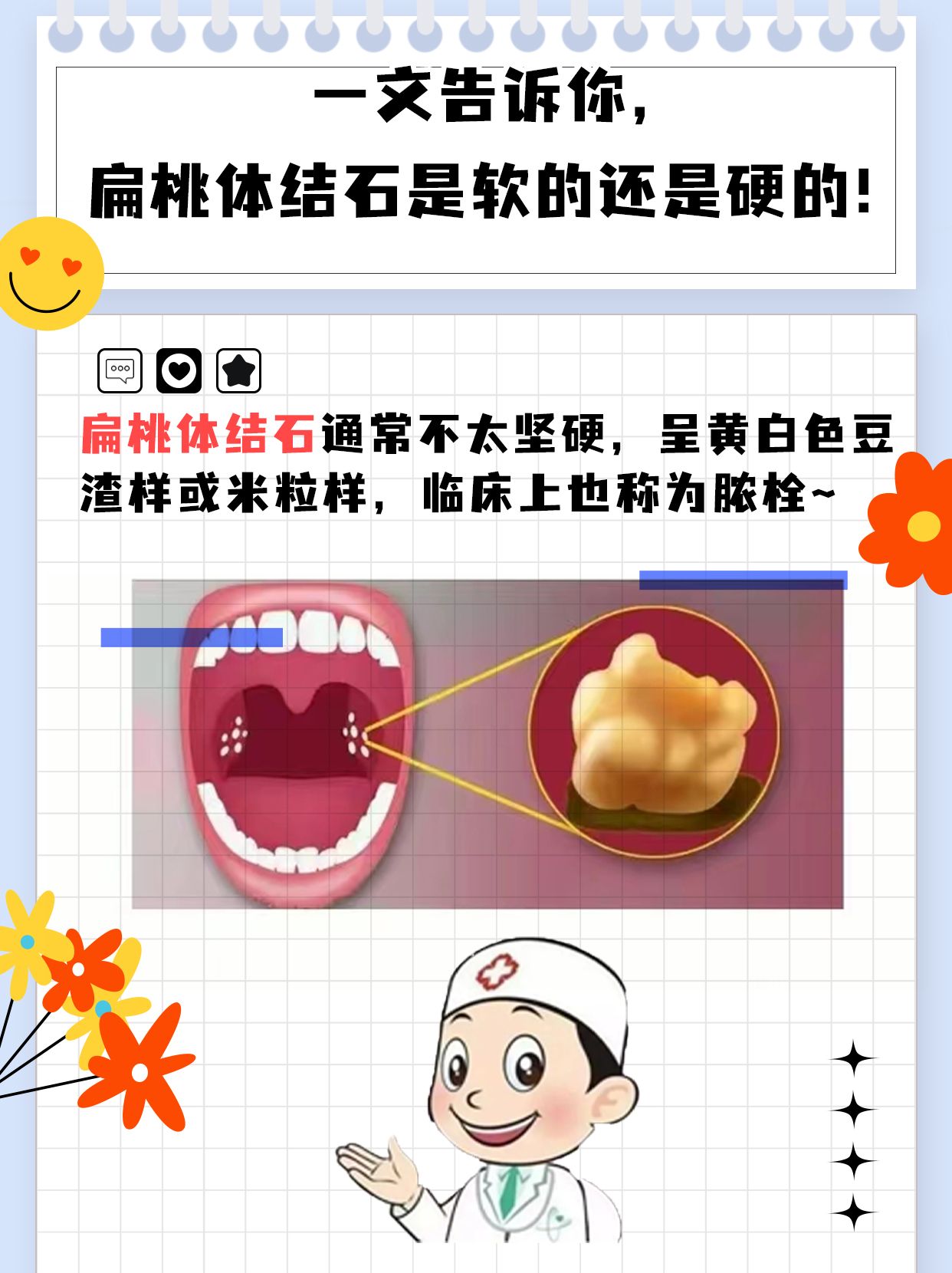 一文告诉你，扁桃体结石是软的还是硬的！