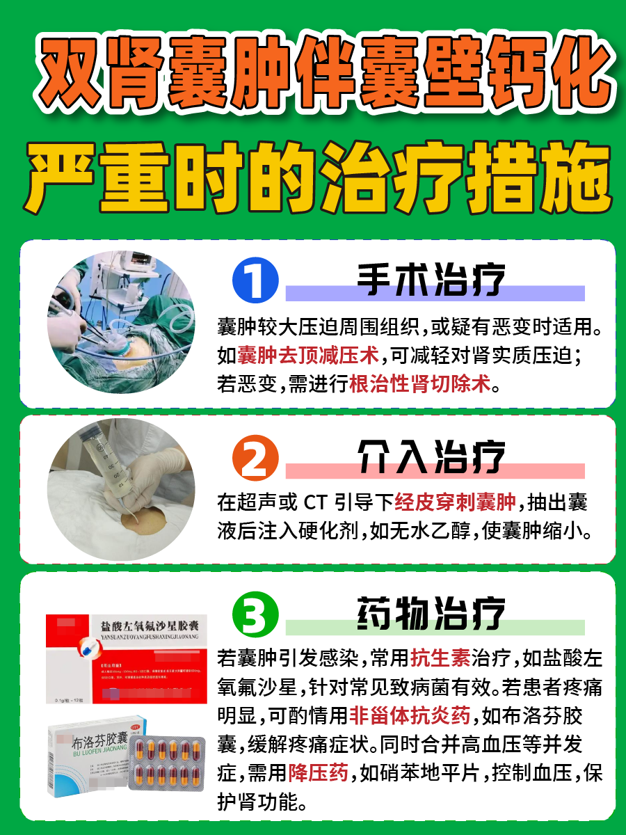 双肾囊肿钙化，肾脏在向你求救吗？