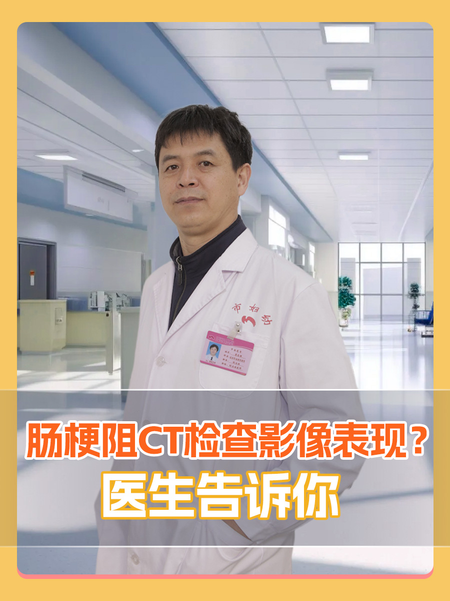 肠梗阻CT检查影像表现?医生告诉你