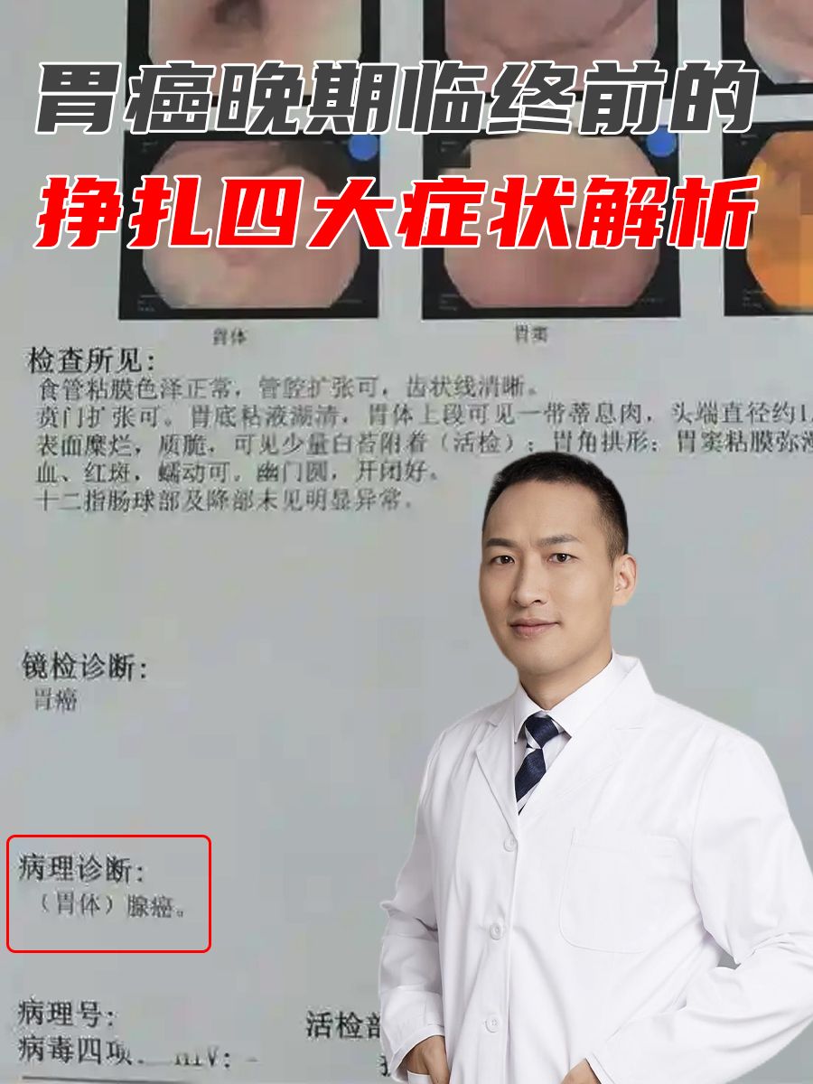 胃癌晚期临终前的挣扎，四大症状表现解析