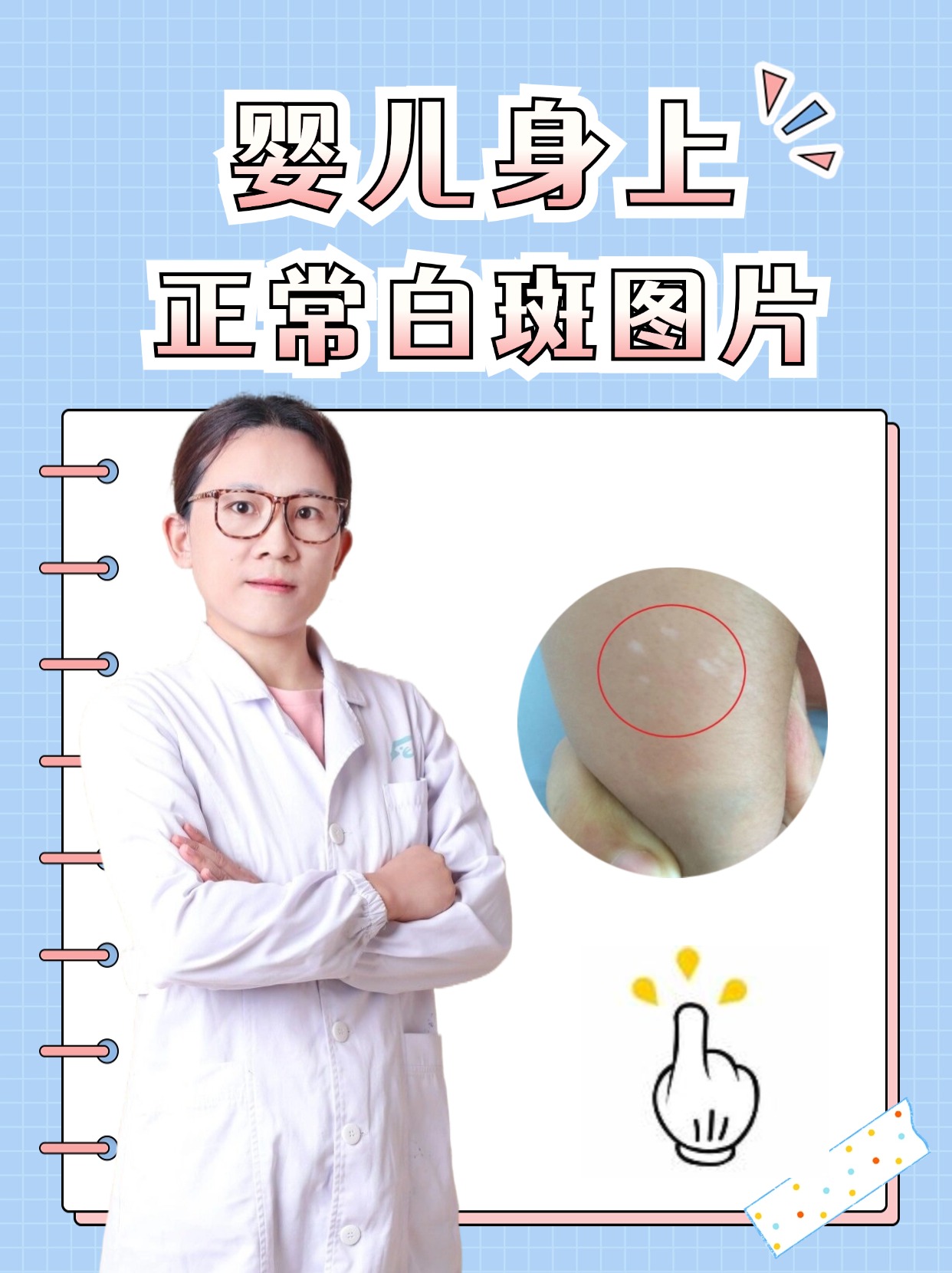 婴儿身上正常白斑图片