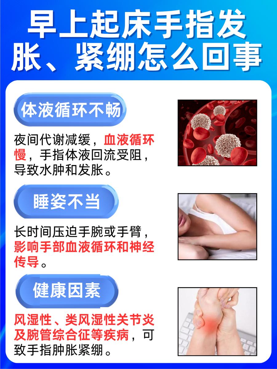解析:早上起床手指发胀、紧绷怎么回事