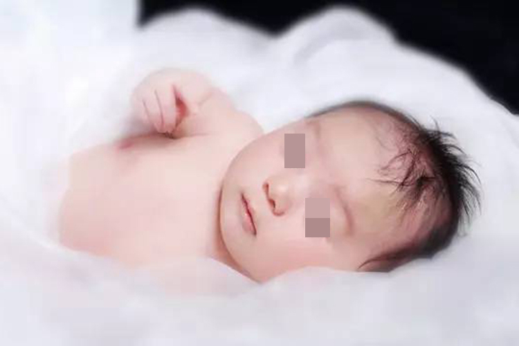 正常新生儿皮肤颜色图