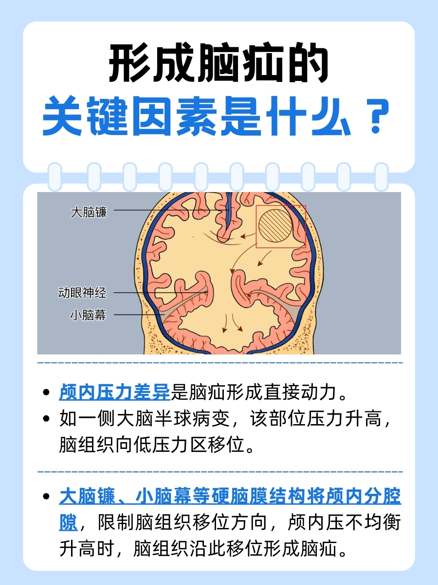脑疝形成的关键因素，你get到了吗