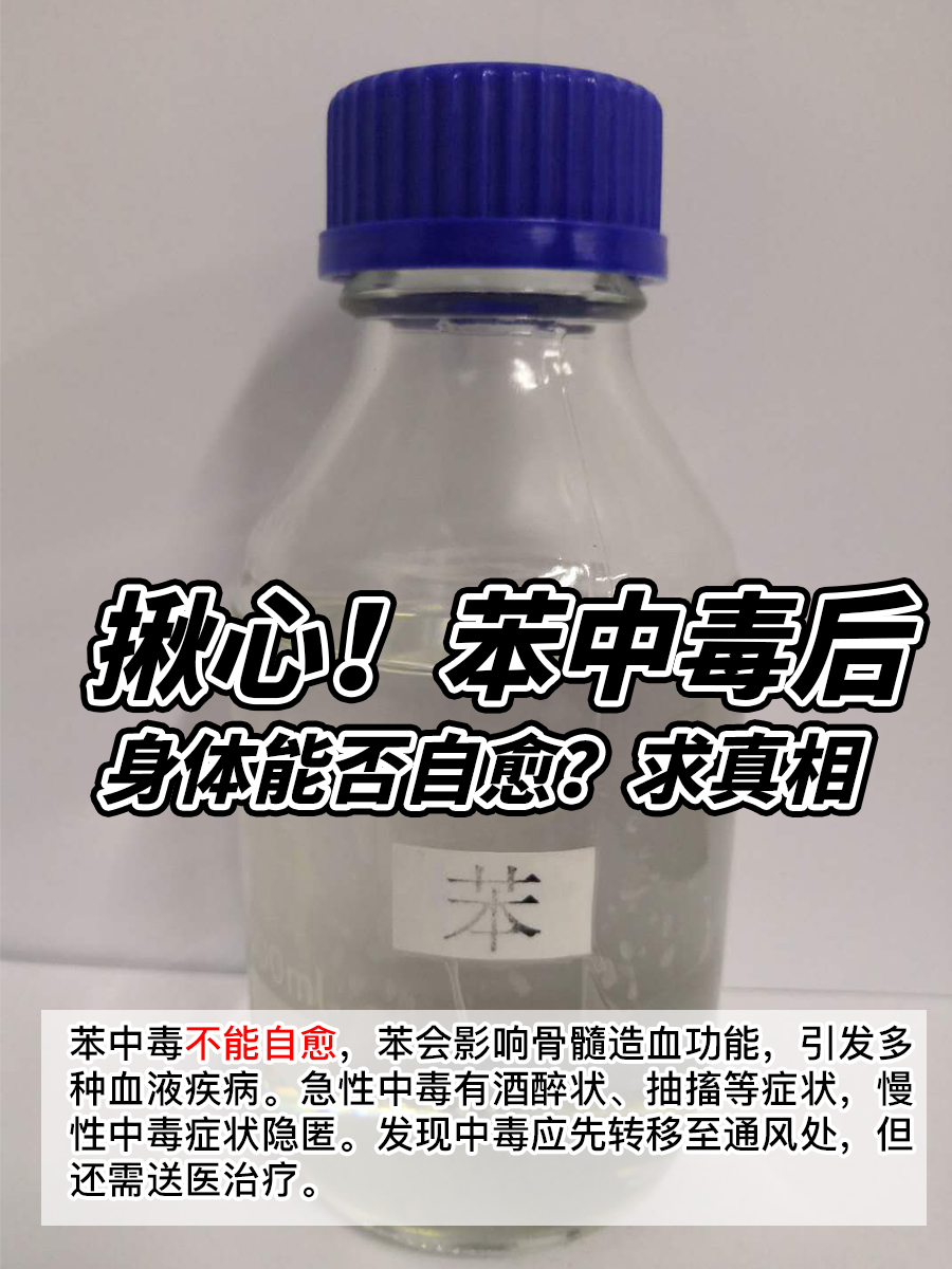 揪心!苯中毒后,身体能否自愈?求真相