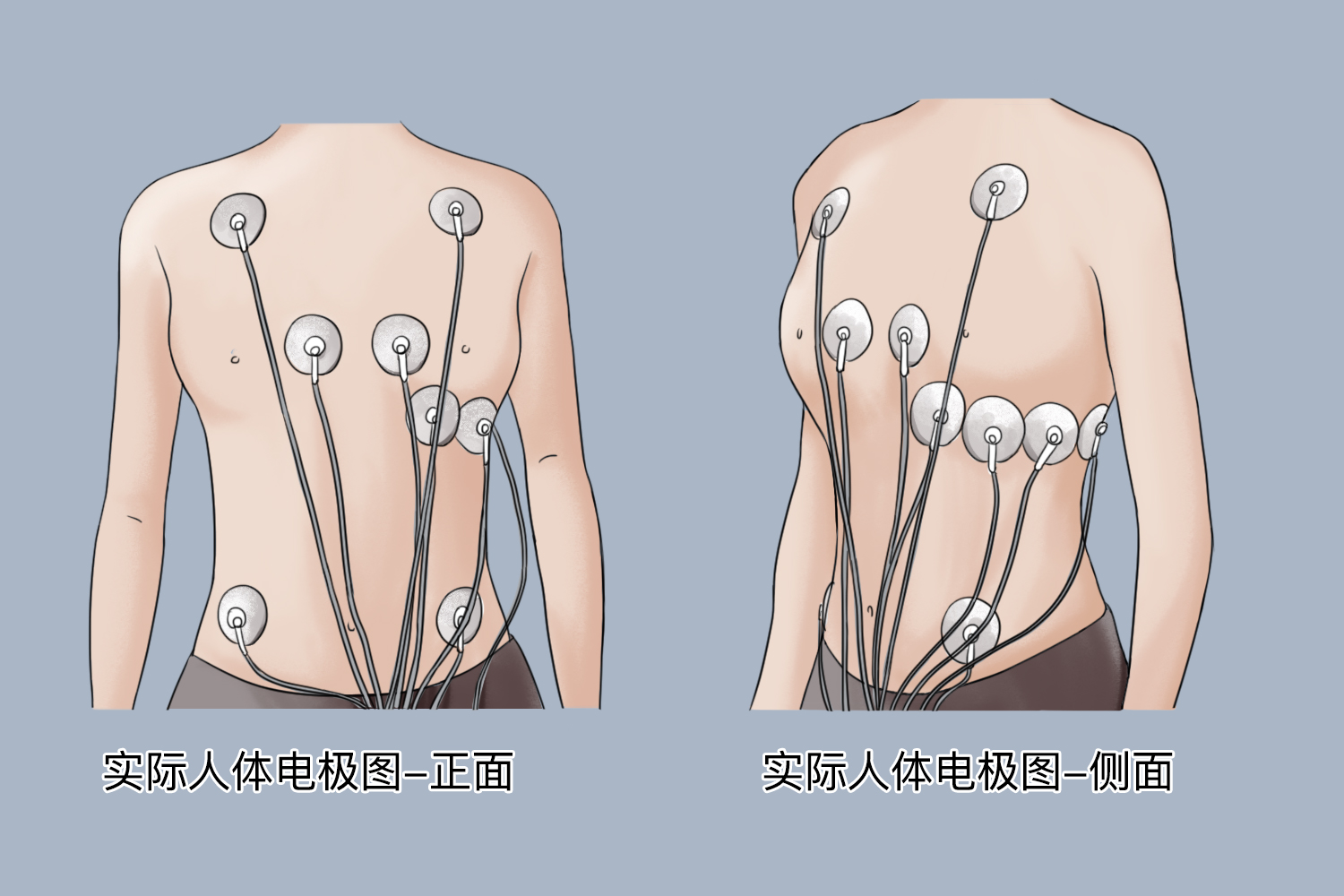 女生24小时心电图佩戴图