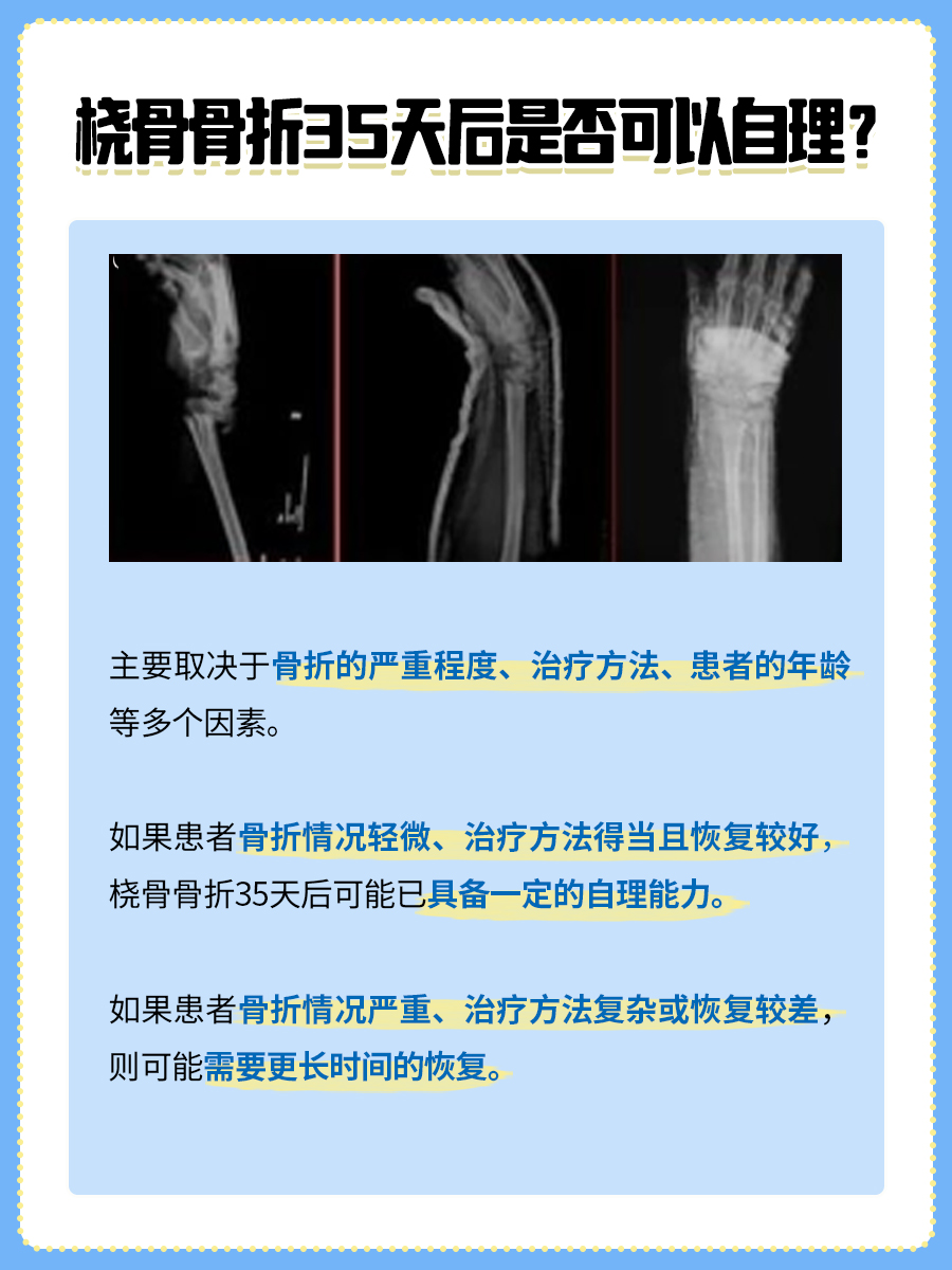 医生详解：桡骨骨折35天后可以自理吗