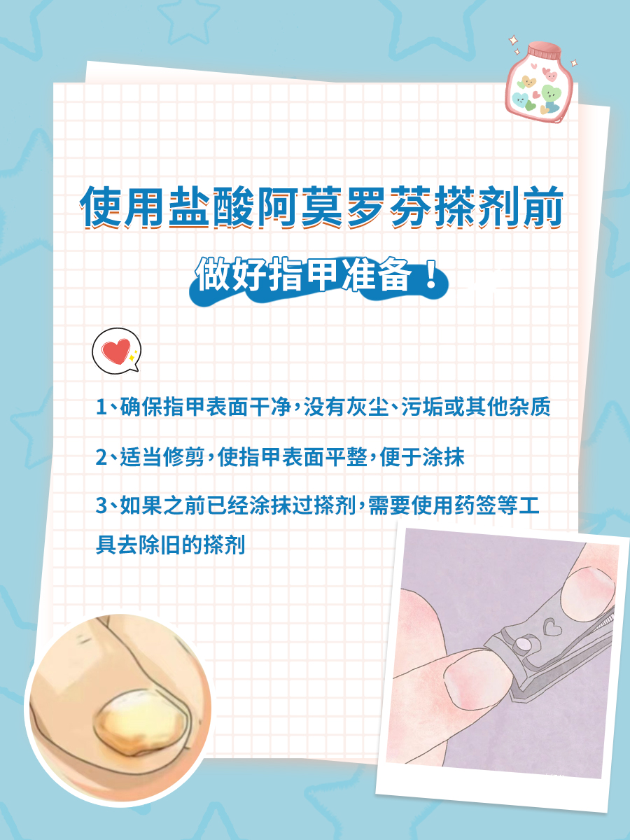 想知道盐酸阿莫罗芬搽剂价格？看这里就够了！