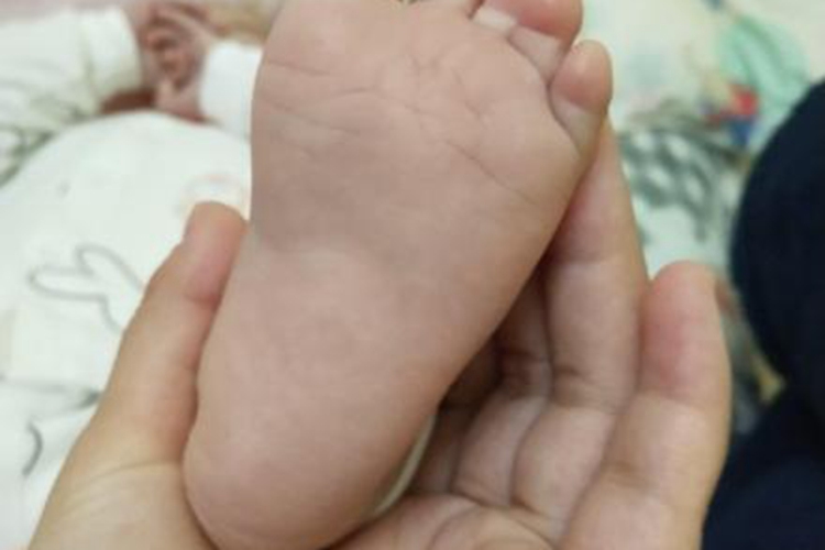宝宝正常足图 宝宝正常足图