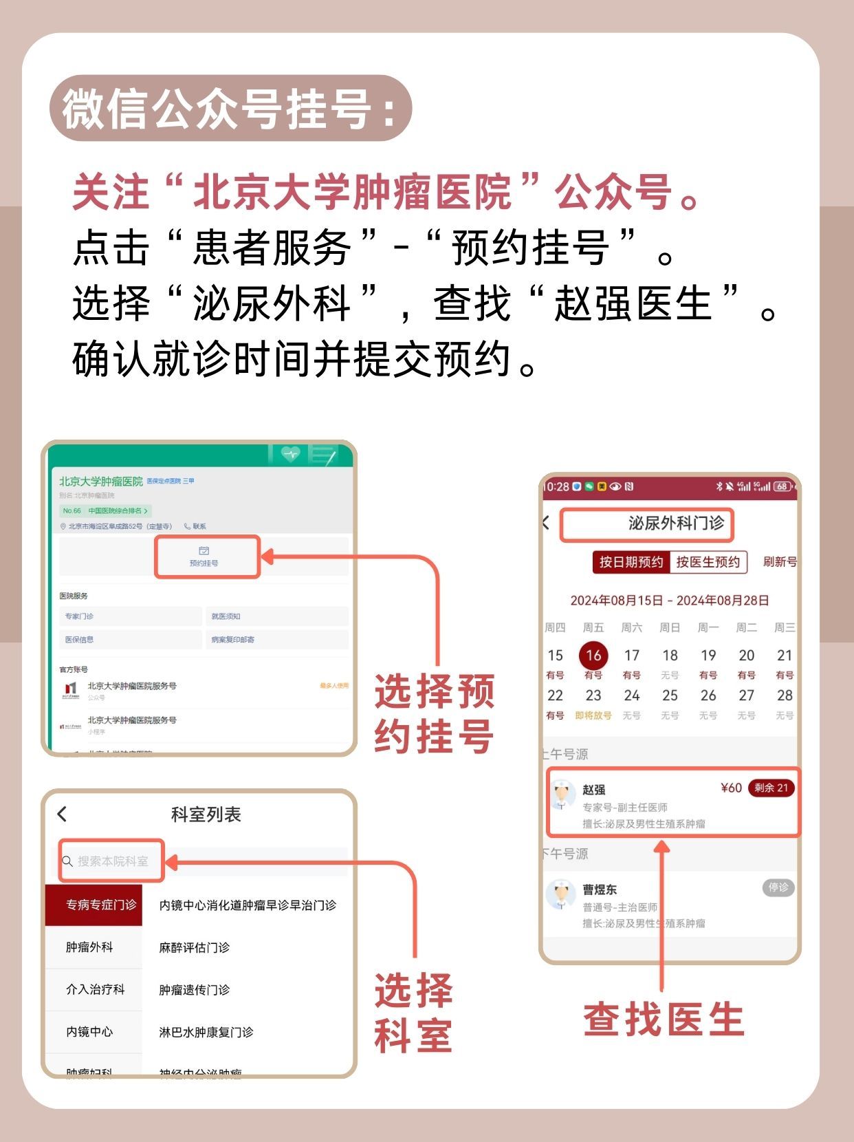 北京大学肿瘤医院赵强医生怎么样？怎么挂号？