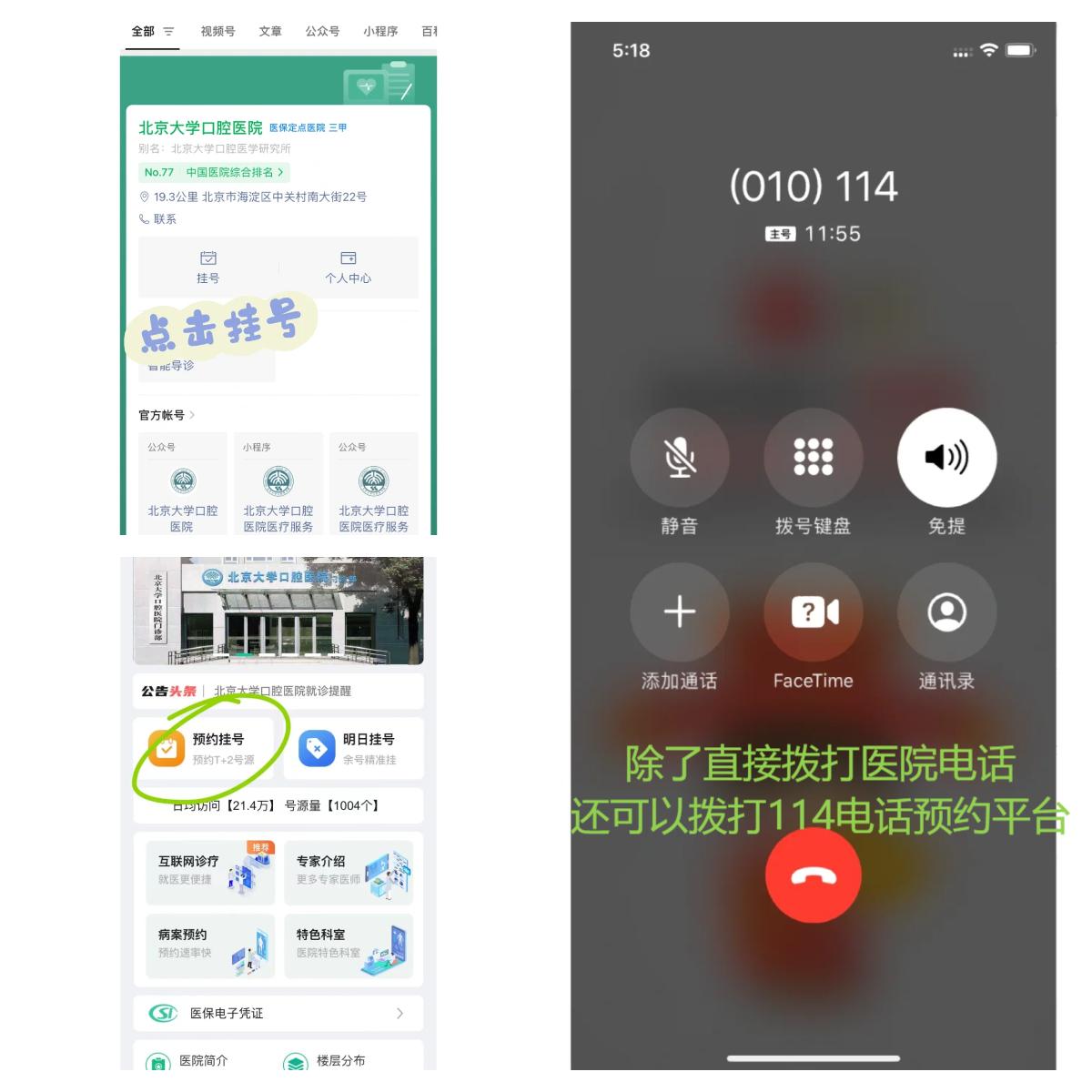 北大口腔医院江久汇医生怎么样？怎么挂号？