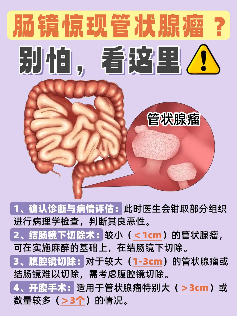 惊了!肠镜查出管状腺瘤,该怎么办!