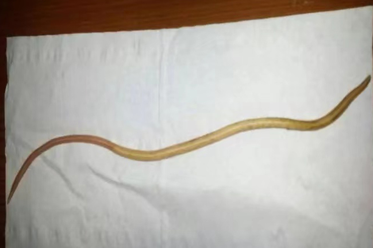 蛔虫成虫外观图