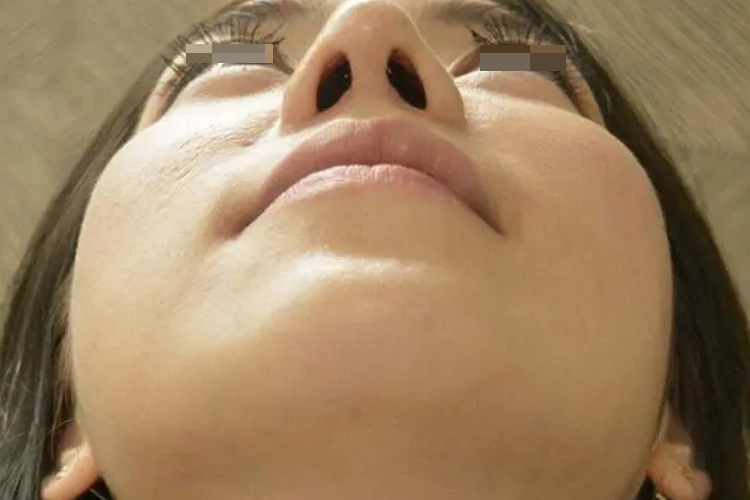 正常鼻腔图