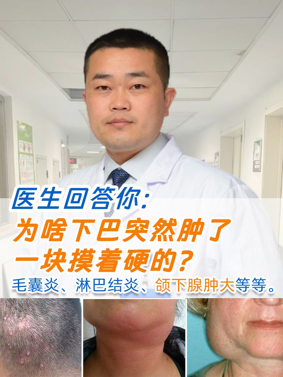 医生回答你：为啥下巴突然肿了一块摸着硬的？