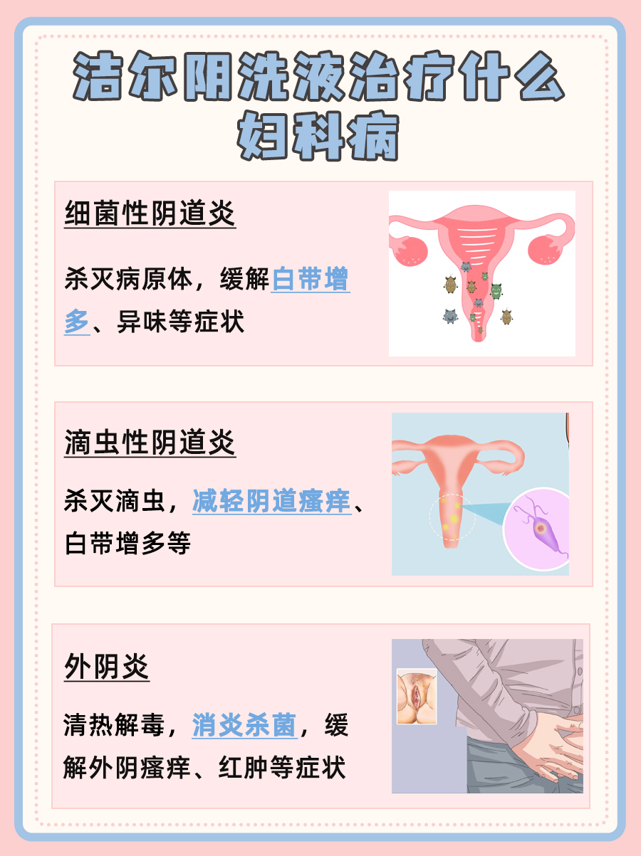 洁尔阴洗液治疗什么妇科病？一文了解