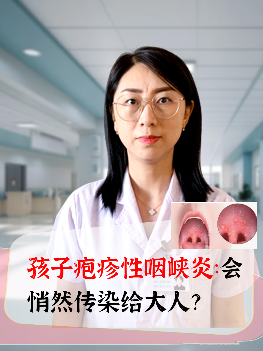 孩子疱疹性咽峡炎：会悄然传染给大人？
