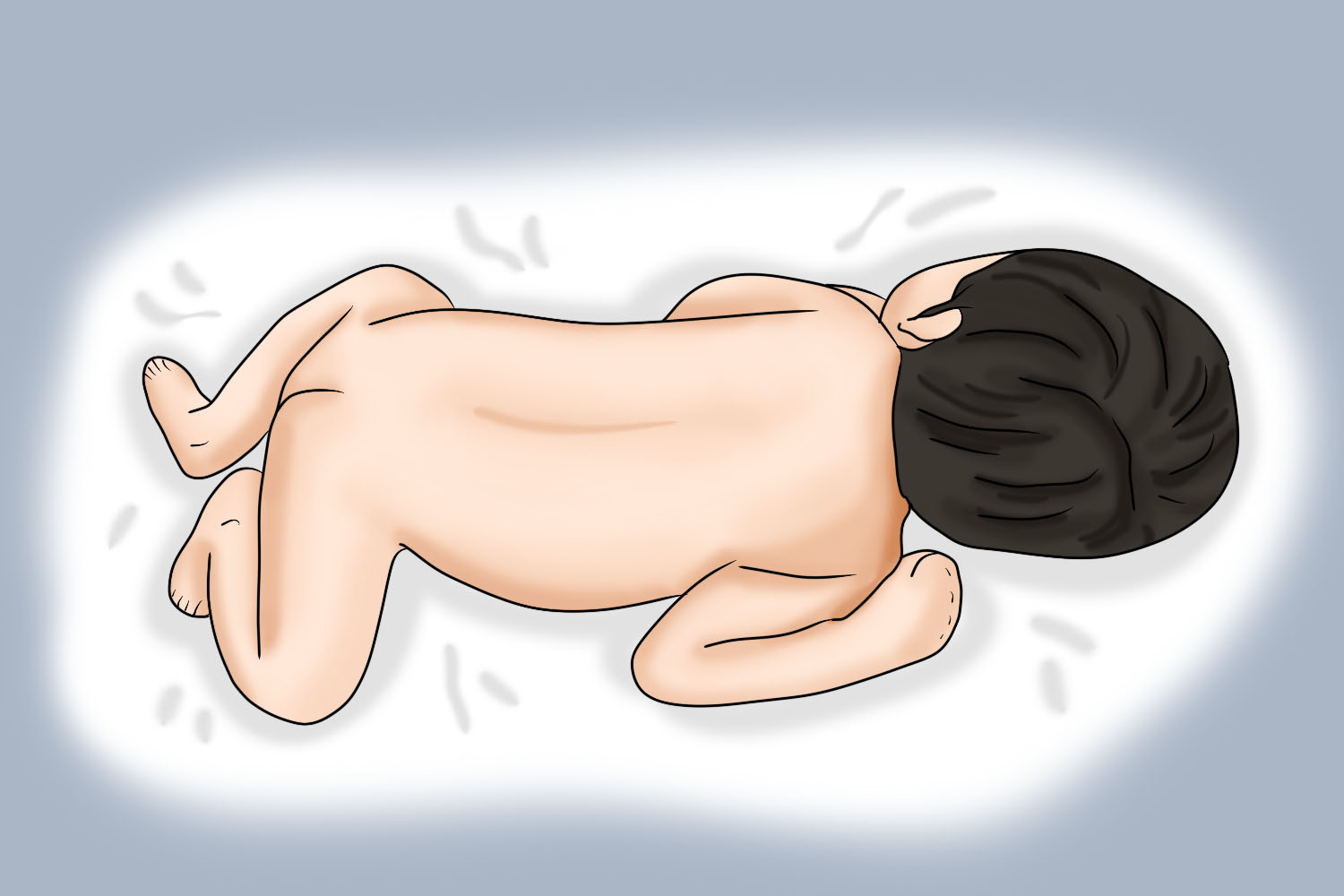 婴儿脑瘫蛙位姿势图 婴儿脑瘫蛙位姿势图