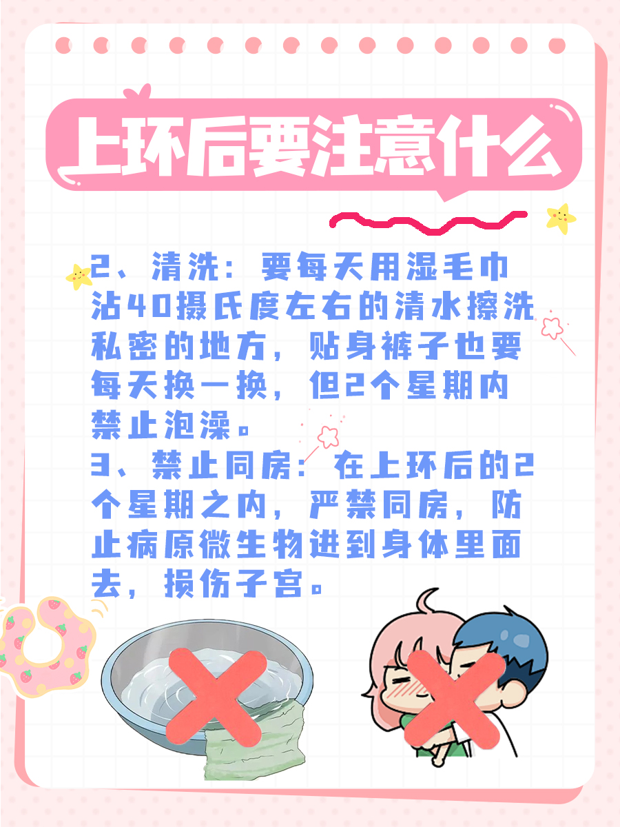 节育环解析只之——吉尼环