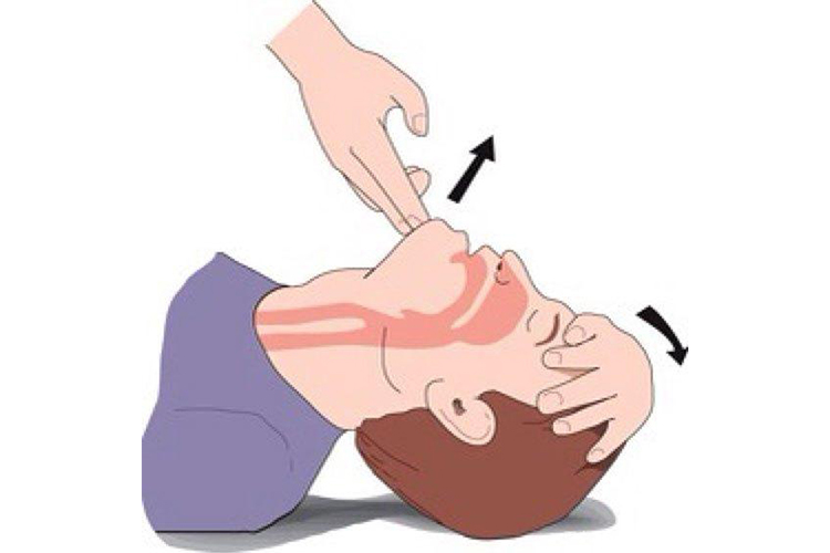 仰头举颌法方法图 仰头举颌法方法图