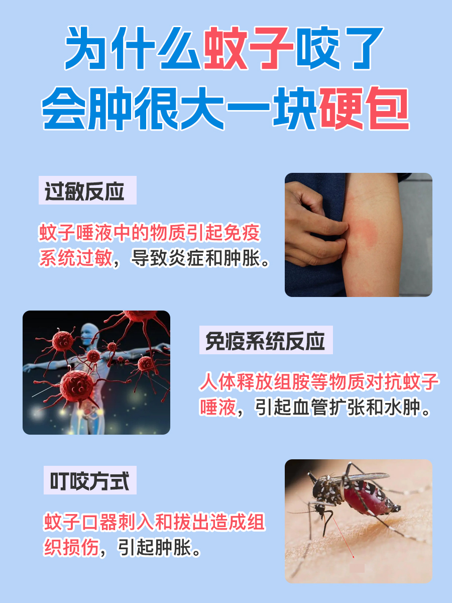 蚊子叮咬引发的肿胀：皮肤上的“硬包”之谜