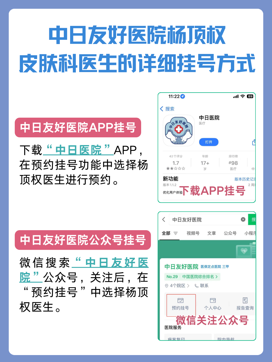 中日友好医院杨顶权医生怎么样?怎么挂号?